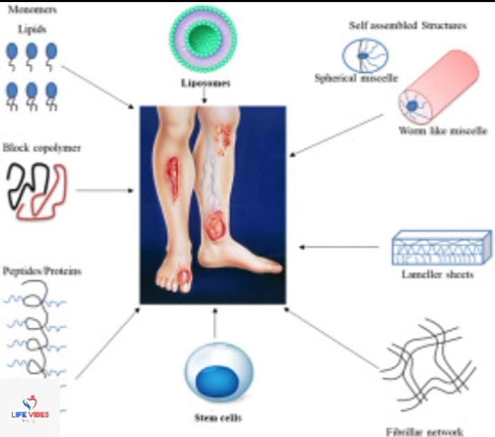 Chronic Wound Management