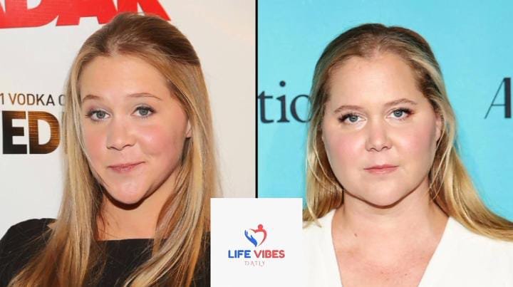 Amy Schumer's Swollen Face And Plastic Surgery