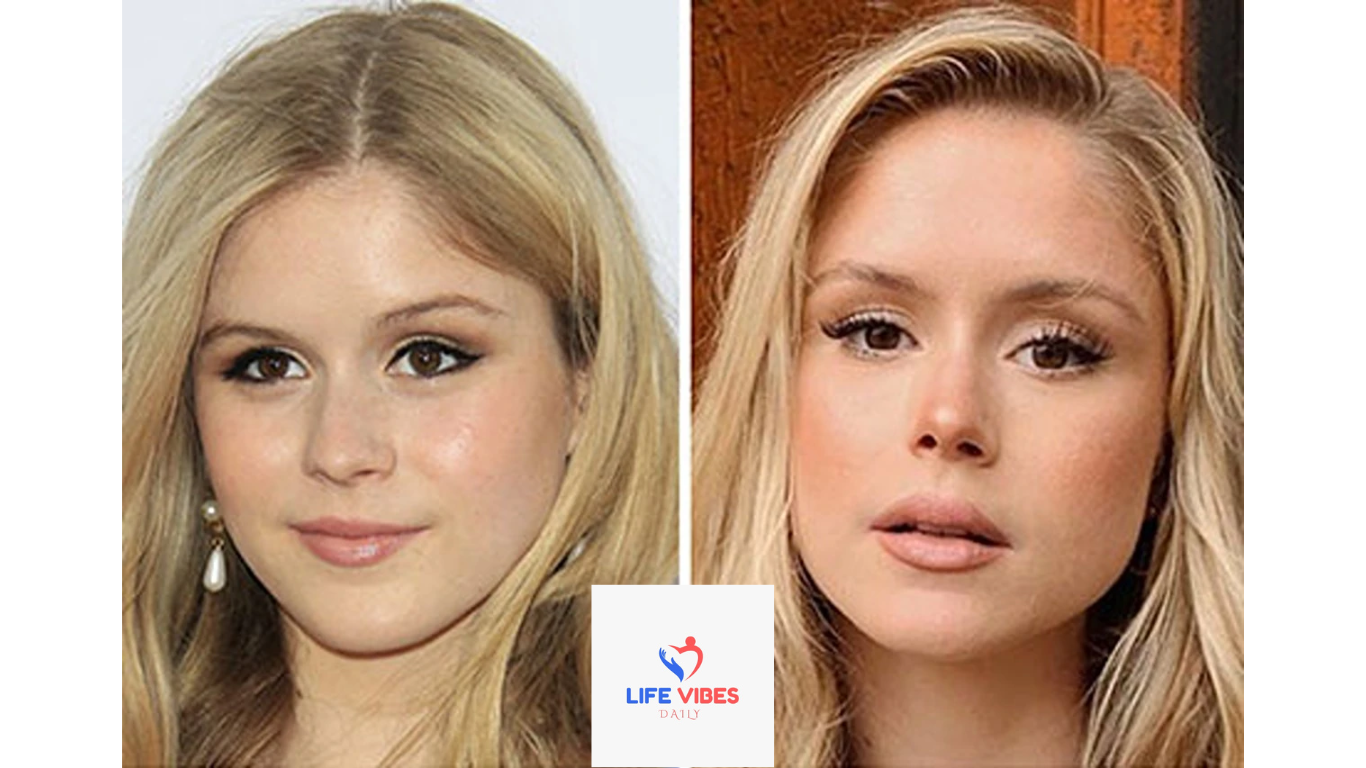 Erin Moriarty Plastic Surgery Weight Loss