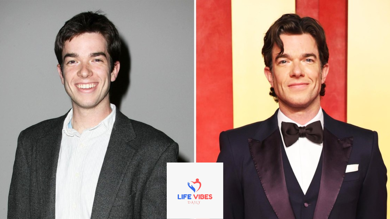 John Mulaney Plastic Surgery